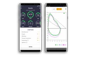 Spirometer Mobile App